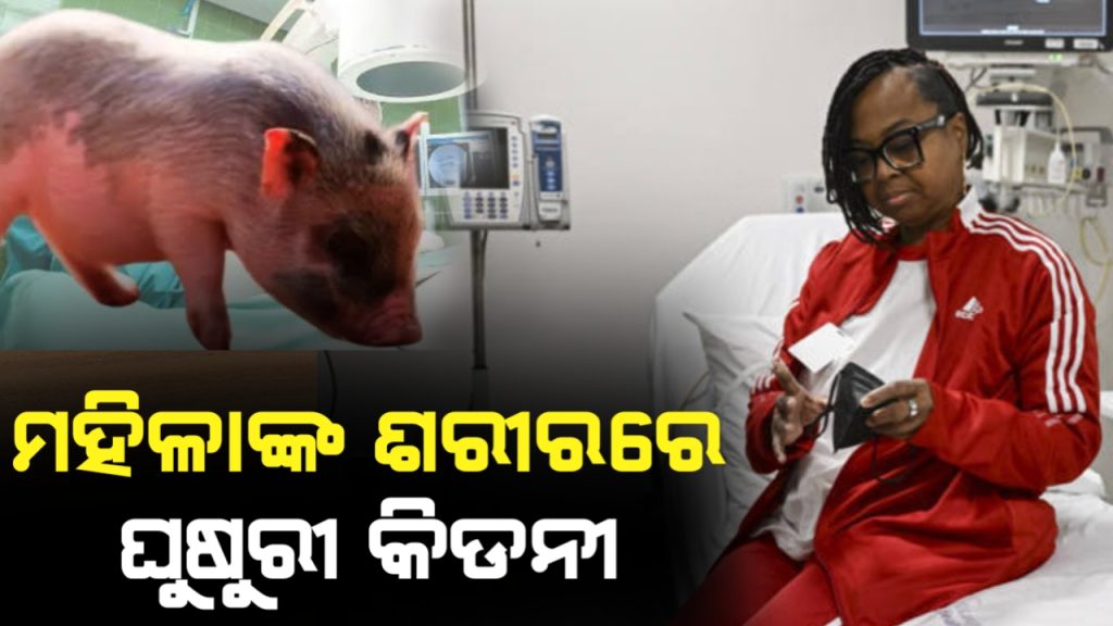 ମଣିଷ ଶରୀରରେ ଲାଗିଥିଲା ଘୁଷୁରୀ କିଡନୀ, ୧୩୦ ଦିନ ବଞ୍ଚିଲେ ମହିଳା