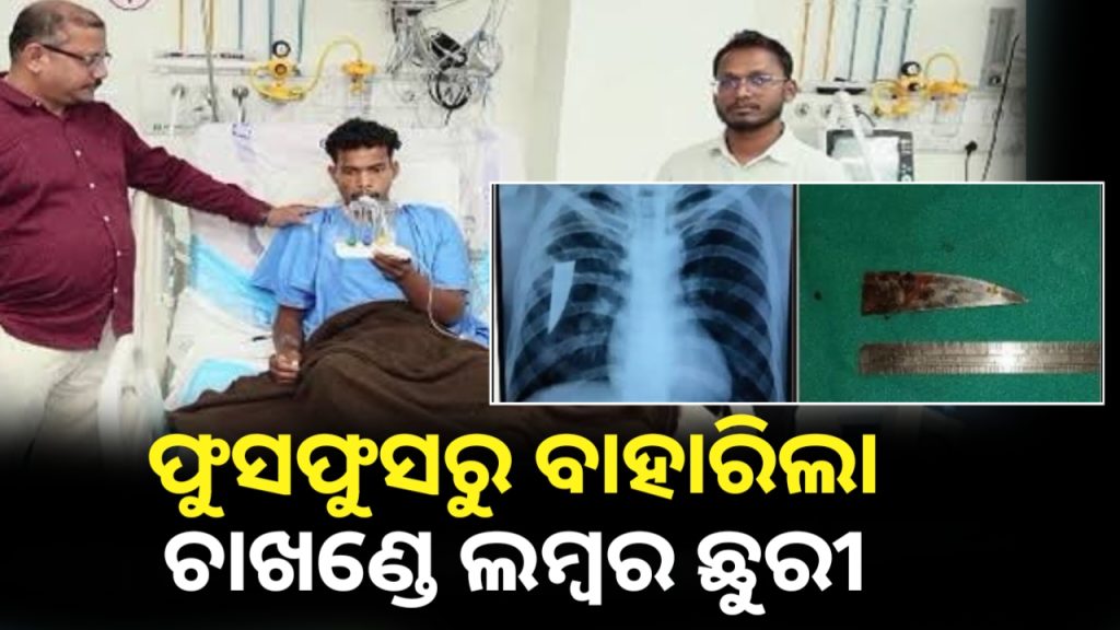 ତିନି ବର୍ଷ ଧରି ଫୁସଫୁସରେ ଫସି ରହିଥିବା ଛୁରୀ ବାହାରିଲା ।